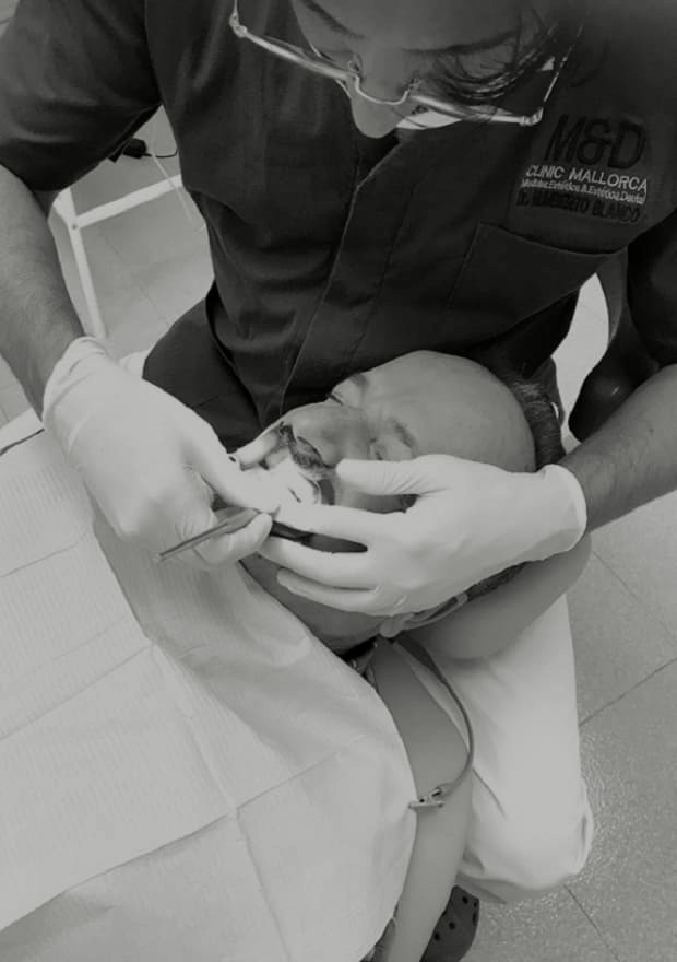 Estética-Dental-Clinic-Mallorca-MED-Palma